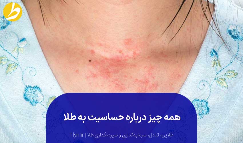 حساسیت به طلا چیست؟ راه‌های درمان آلرژی طلا