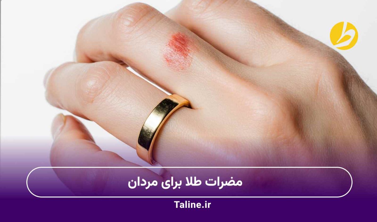 مضرات طلا برای مردان